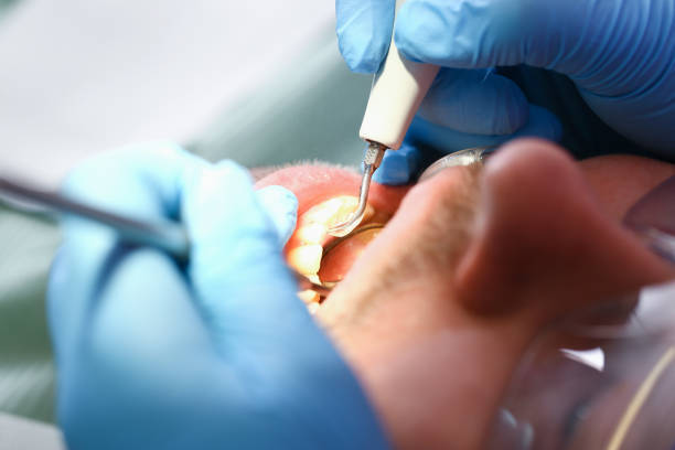 Best After-Hours Emergency Dentist in Arbury Hls, IL