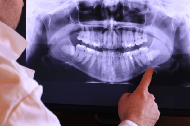 Best Emergency Dental Care for Trauma or Injury in Arbury Hls, IL