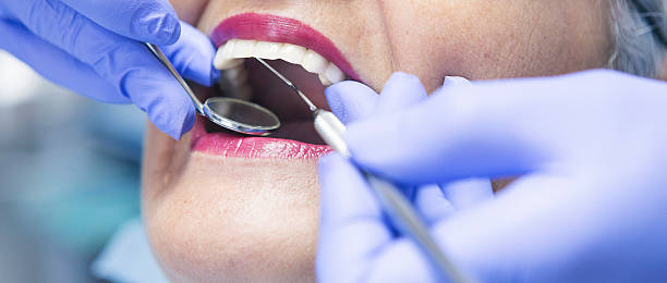 Best Emergency Dental Surgery in Arbury Hls, IL