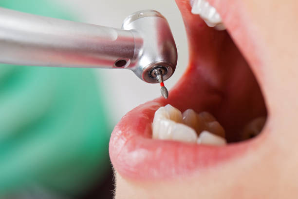 Best Pediatric Emergency Dentist in Arbury Hls, IL